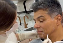 Maurício Mattar faz harmonização facial e comemora resultado natural: ‘Natural’