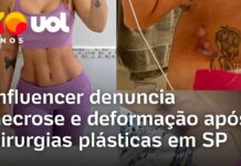 Veja Vídeo – Influenciadora relata drama após sofrer necrose e deformações em cirurgia em SP