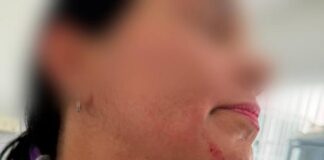 Servidora é agredida por paciente em unidade de saúde