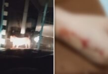 Família é obrigada a dormir dentro de carro após ataque de pitbull no quintal de casa
