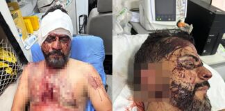 Vereador torturado durante roubo volta à UPA após piora nas dores